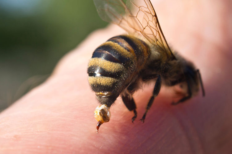 co zrobić jak użądli pszczoła